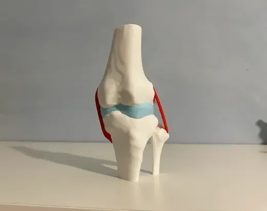Knee with Meniscus and Collateral Ligaments
