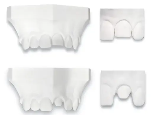 Anterior Crown Prep vs Veneer Prep Demo Model