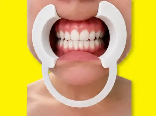 Dental Cheek Retractor ergonomic and flexible