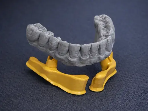 Lower dental Ibar Toronto Bridge