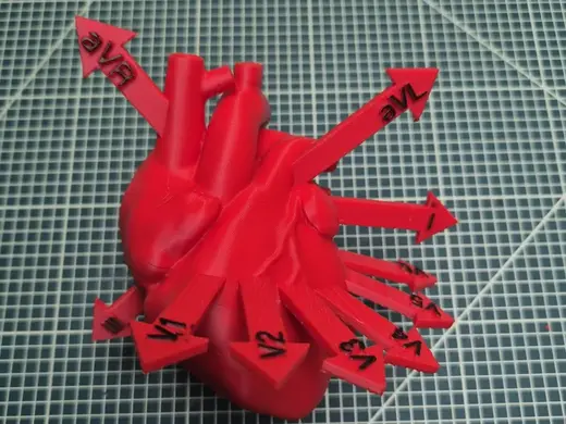 Heart with ECG Leads visualized