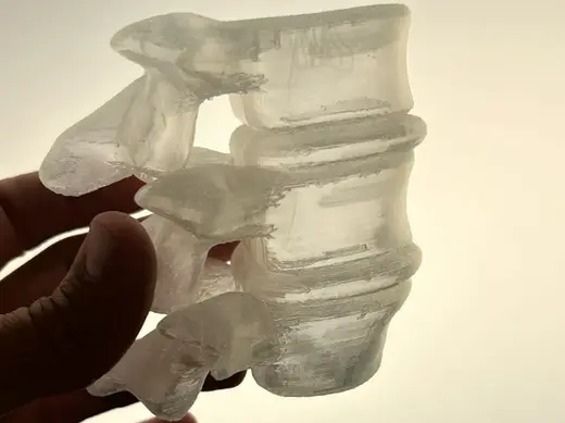 Vertebra L3-L5 translucent for dry needling bits